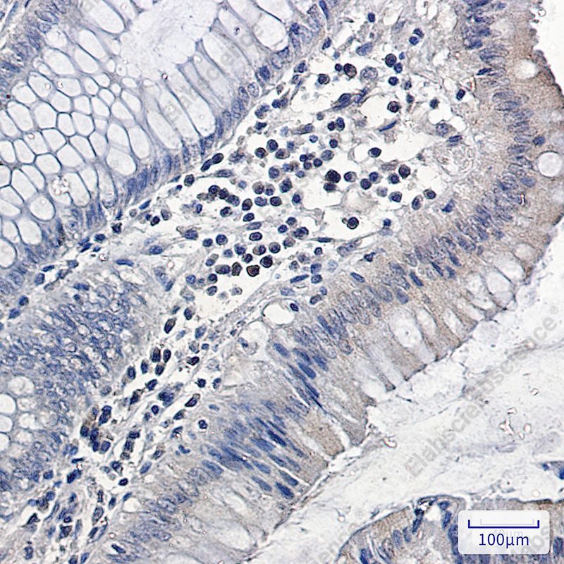 Recombinant MAPK6 Monoclonal Antibody - 2