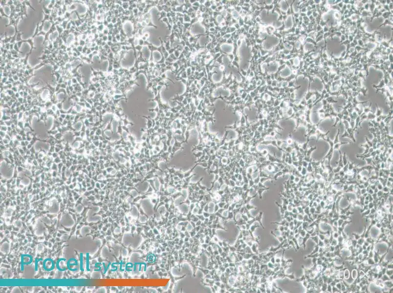 HKb20 Cell Complete MediumHKb20 Cell Complete Medium - 3