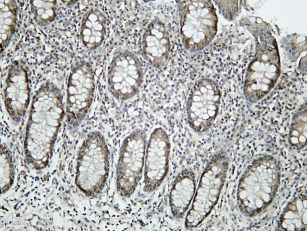 Recombinant Caspase-11 Monoclonal Antibody - 1