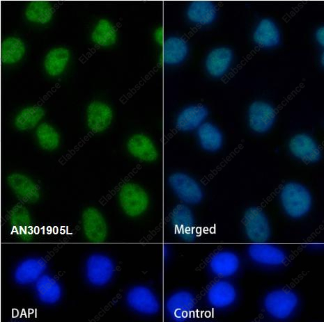 Recombinant MBD2 Monoclonal Antibody - 4