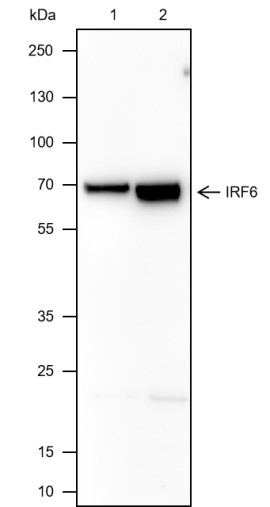 Recombinant IRF6 Monoclonal Antibody-searchlist-1