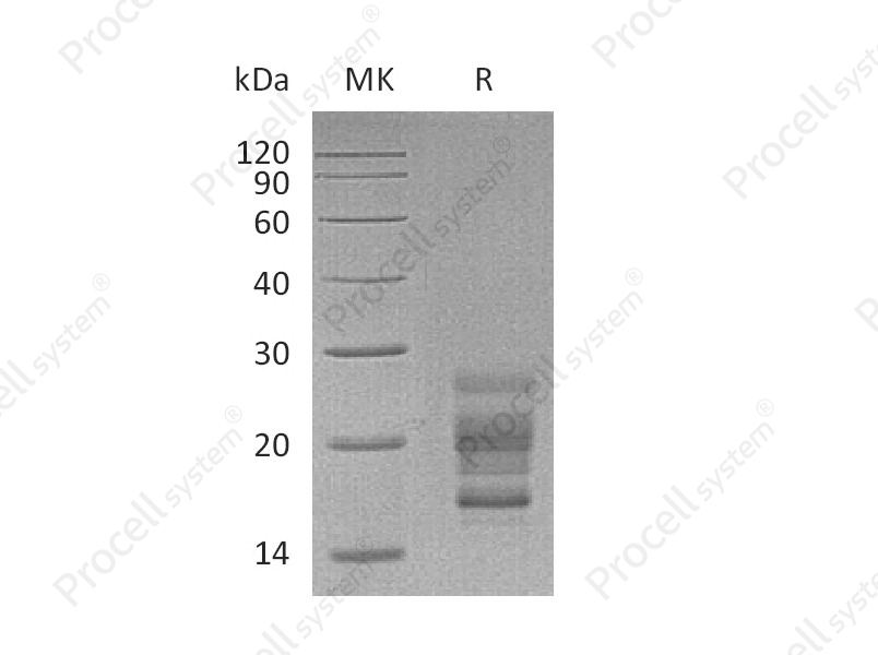 IL-17A/CTLA-8/IL-17, Mouse, Recombinant