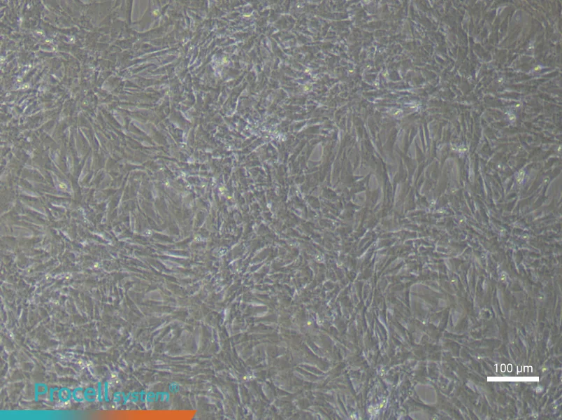 Rat Pulmonary Artery Smooth Muscle Cells (Primary cell immortalization)Rat Pulmonary Artery Smooth Muscle Cells (Primary cell immortalization) - 1