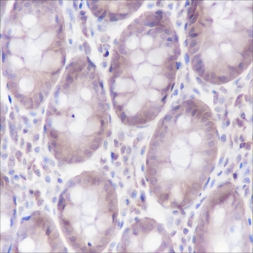 Recombinant alpha Actinin 4 Monoclonal Antibody - 2