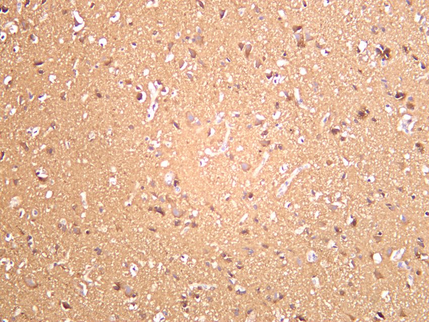 Recombinant LC3B Monoclonal Antibody - small - 5