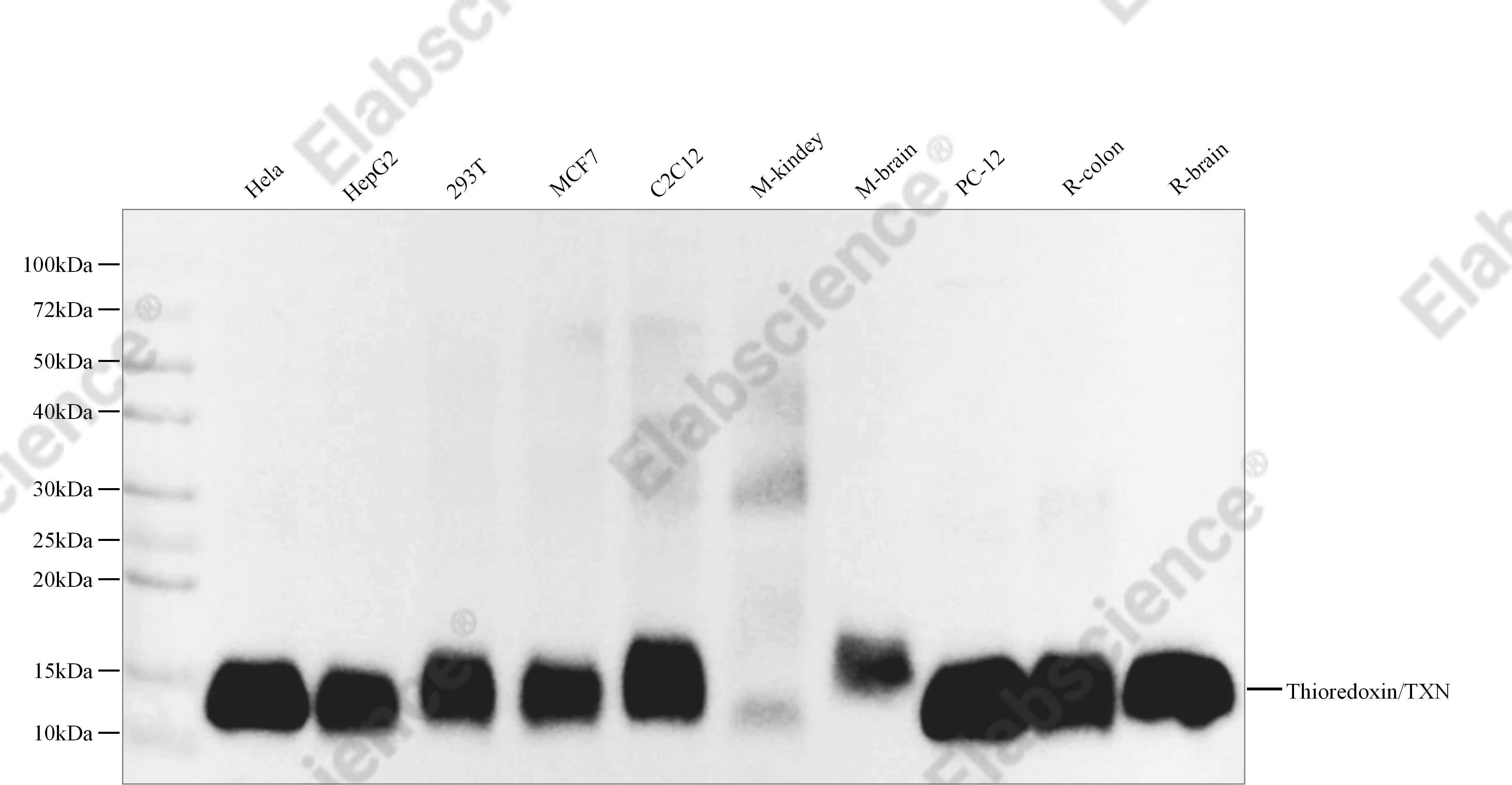 Recombinant Thioredoxin/TXN Monoclonal Antibody - 1