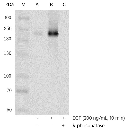 Recombinant Phospho-HER2/ErbB2 (Tyr1221, 1222) Monoclonal Antibody - small - 3