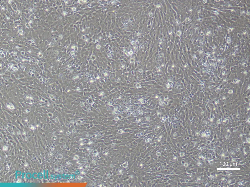 Rat Uterine Smooth Muscle (Primary cell immortalization) Cell Complete MediumRat Uterine Smooth Muscle (Primary cell immortalization) Cell Complete Medium - 2