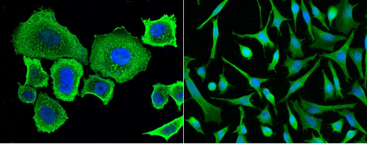 Recombinant SerpinA8/Angiotensinogen/AGT Monoclonal Antibody - small - 2