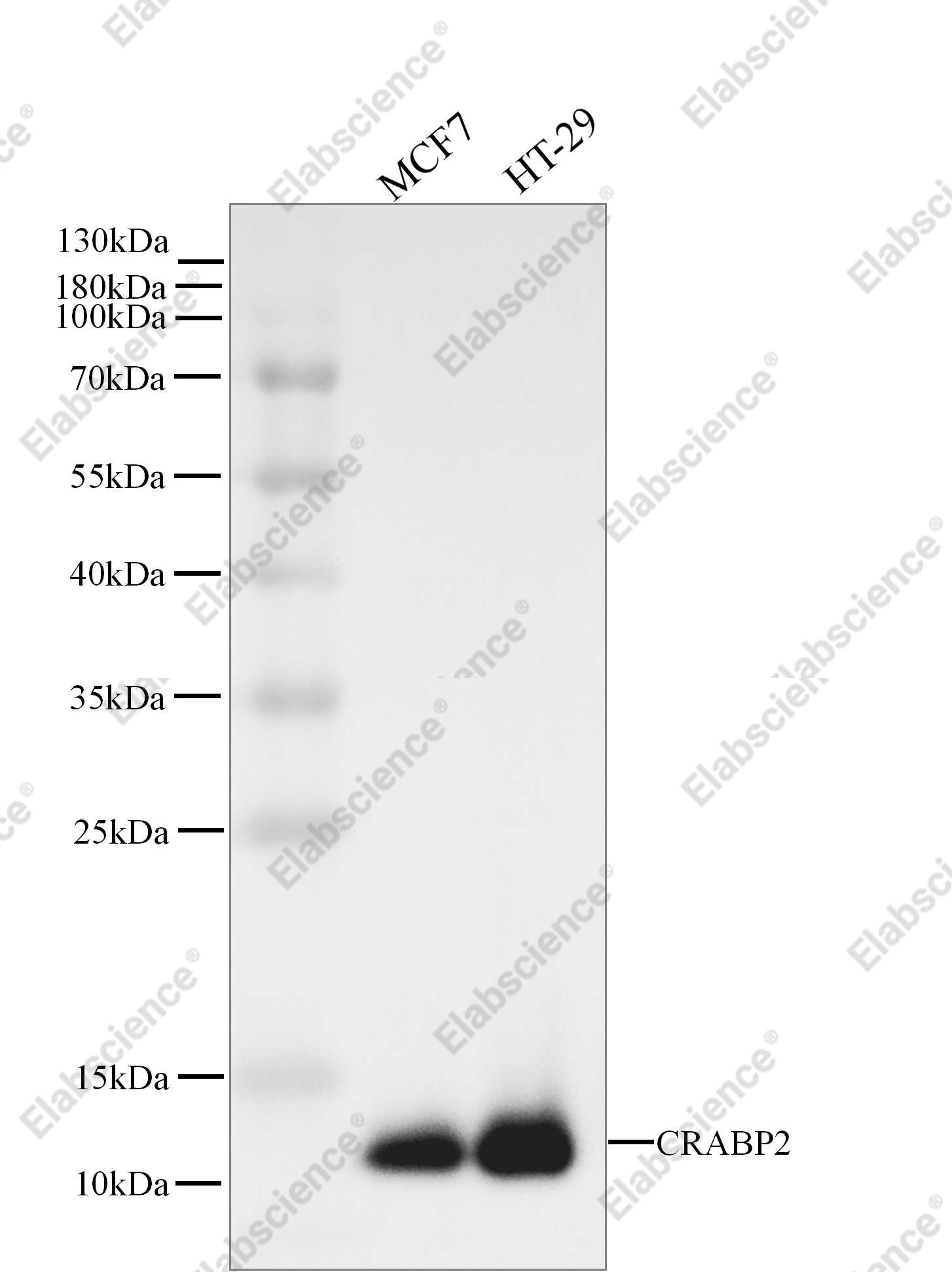 Recombinant CRABP2 Monoclonal Antibody - 1