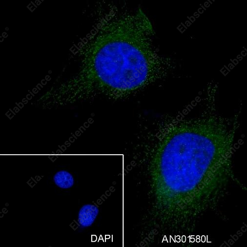 Recombinant Keratin 4 Monoclonal Antibody - 3