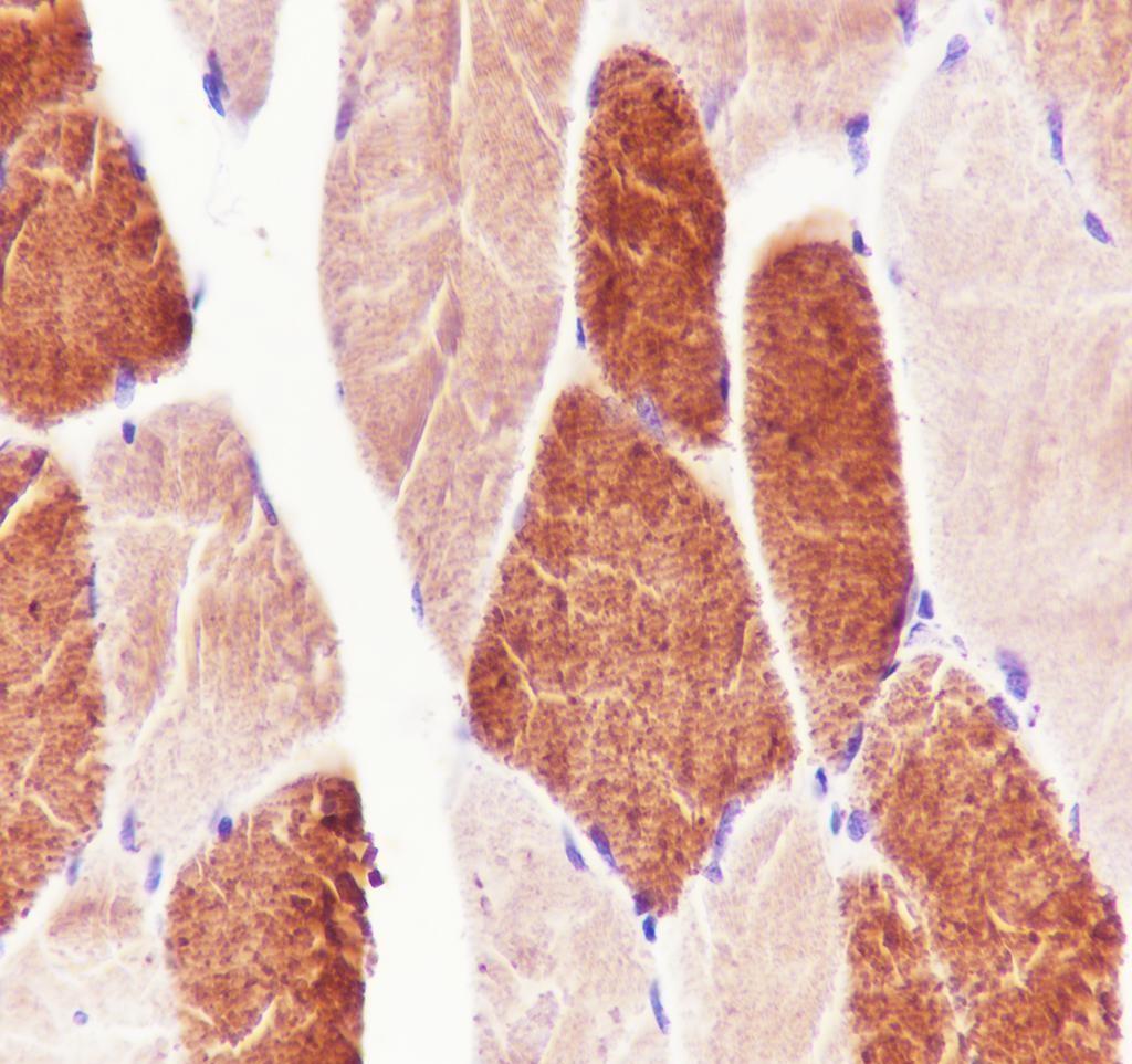 Recombinant MYH7 Monoclonal Antibody - small - 2