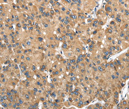 NDUFA5 Polyclonal Antibody - 3