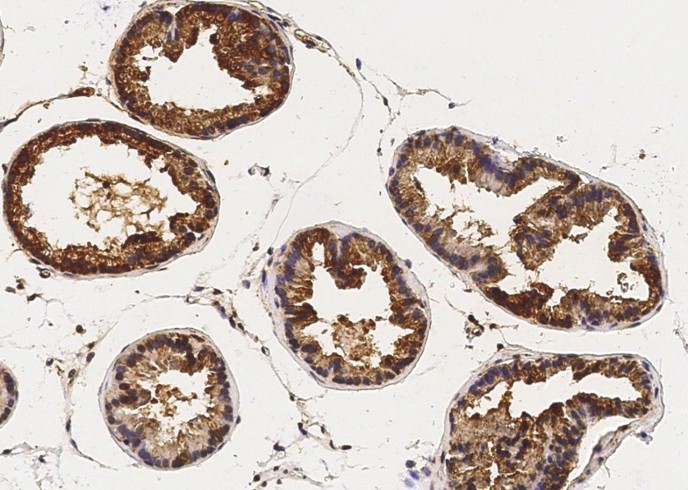 Recombinant CaM Kinase 4/CaMKIV Monoclonal Antibody-searchlist-1