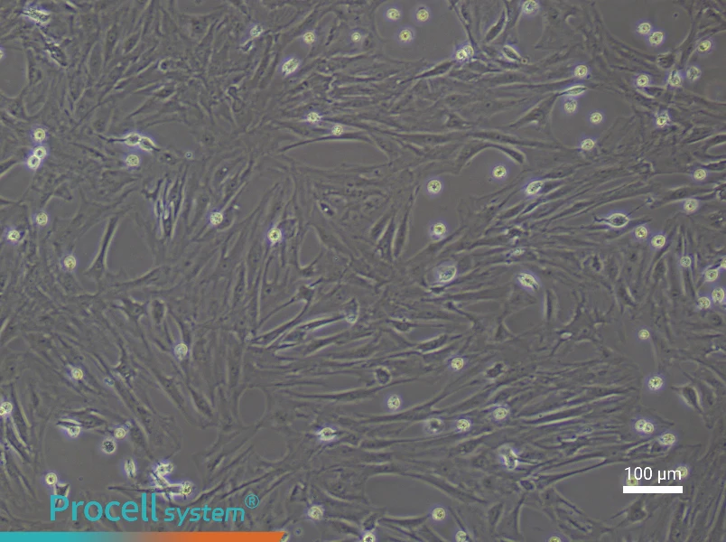 Rat Uterine Fibroblast Complete Medium - 3