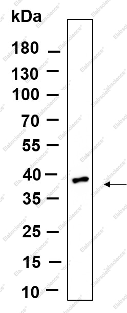 Recombinant OLIG2 Monoclonal Antibody - 1