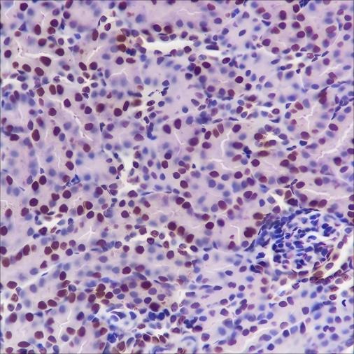 Recombinant SOD1 Monoclonal Antibody - small - 3