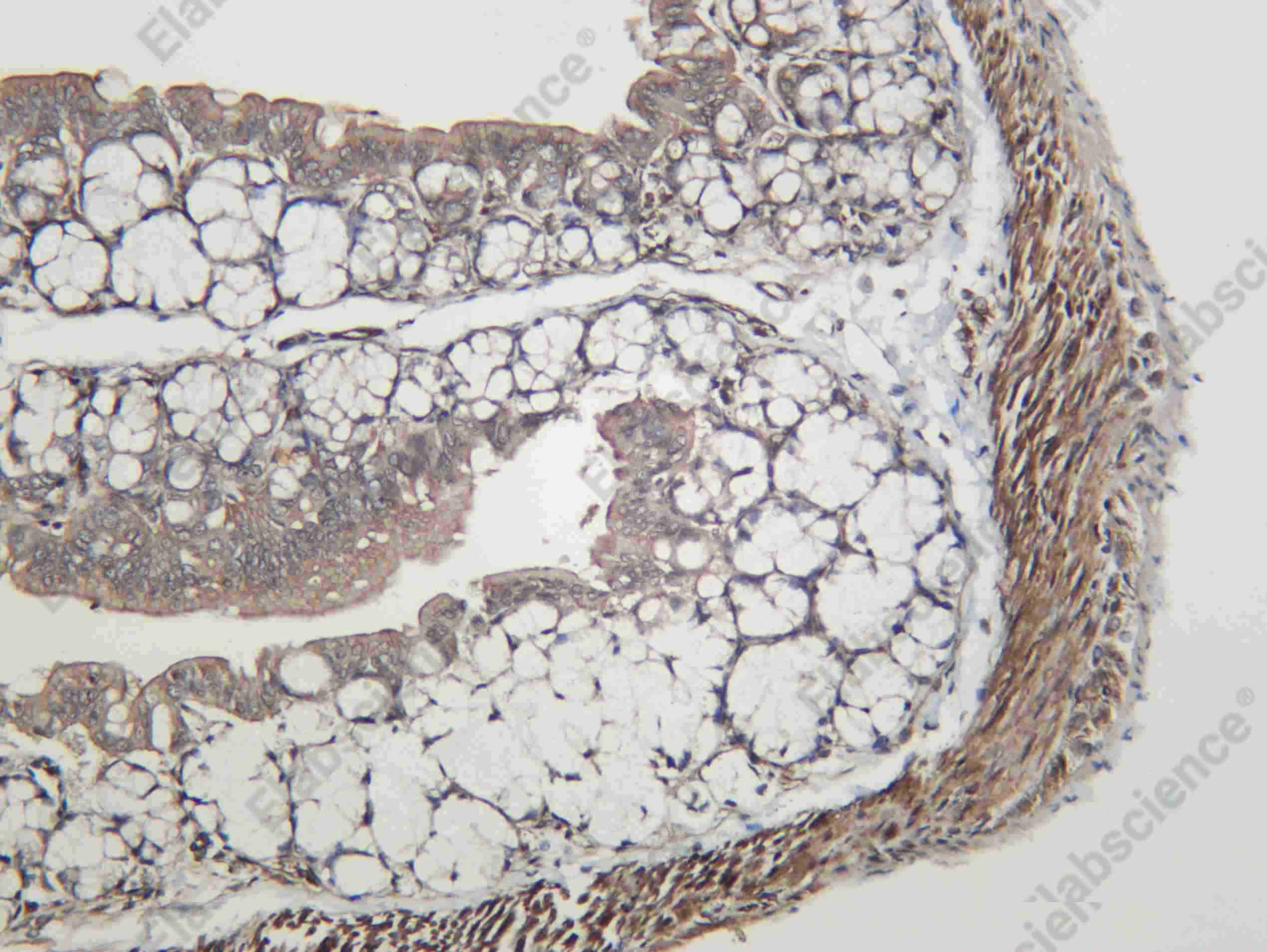 Recombinant Arrestin-β-1 Monoclonal Antibody - 2