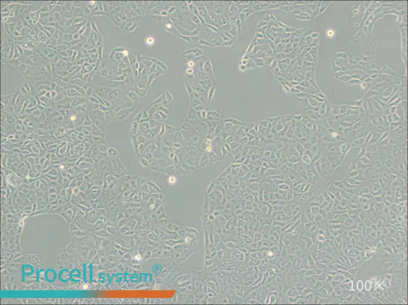 VERO C1008 [Vero E6] Cell Complete Medium - 1