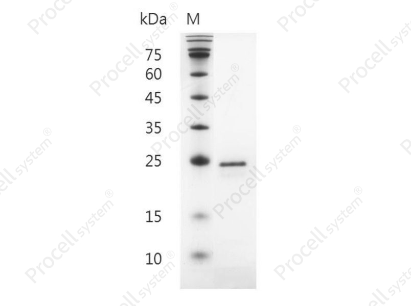 FGF-20/FGFK, Human, Recombinant