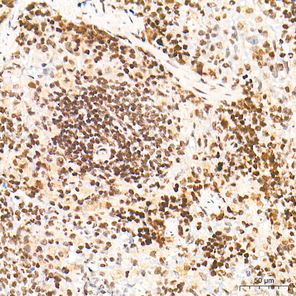 VDR Polyclonal Antibody - small - 5