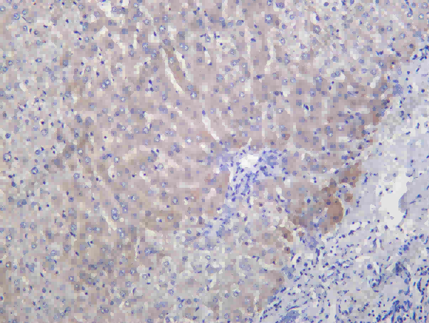 Recombinant PLOD2 Monoclonal Antibody - 1