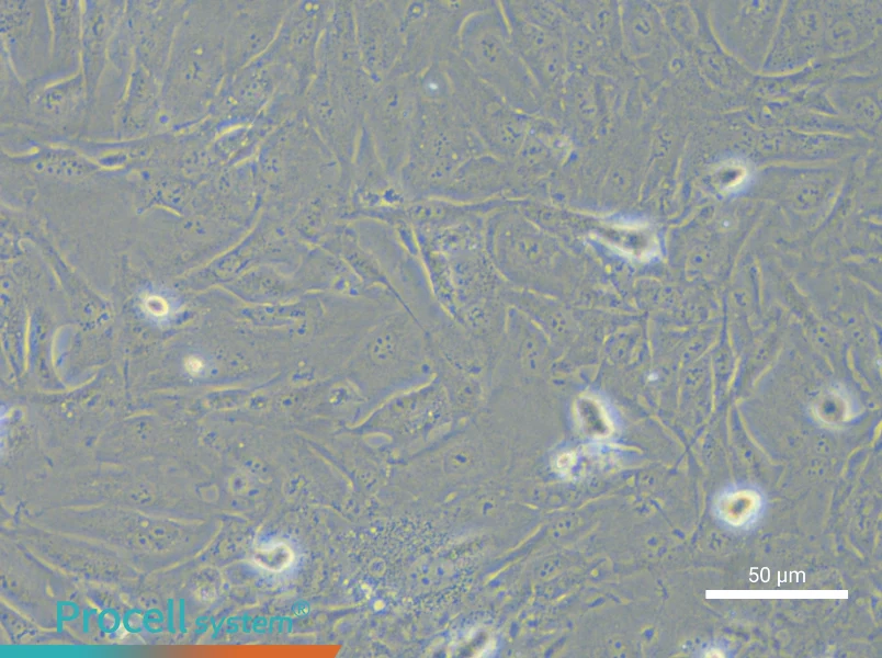 SNU-423 Cell Complete Medium - 5