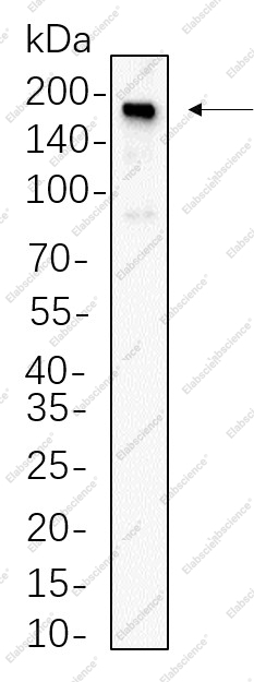 Recombinant Met Monoclonal Antibody - 1