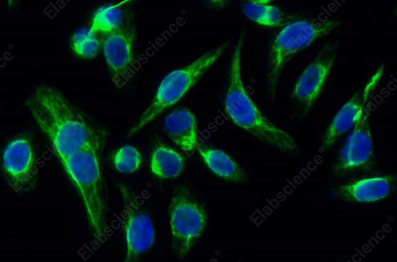 Recombinant p38 Monoclonal Antibody - 4