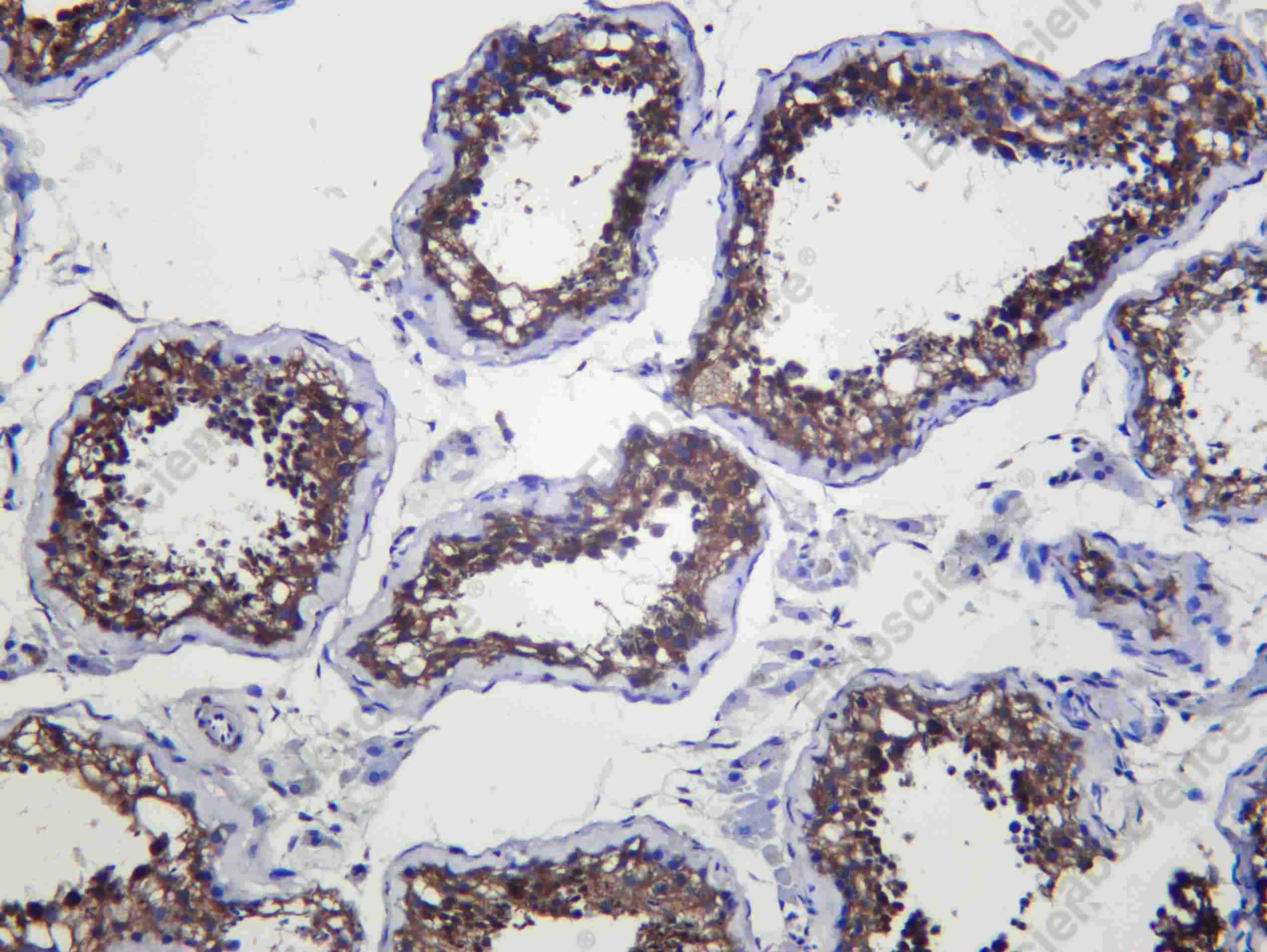 Recombinant CD98 Monoclonal Antibody - 1