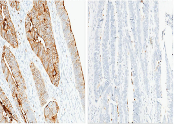CEACAM1/CD66a Monoclonal Antibody - small - 3