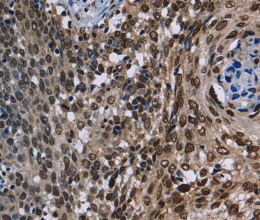 KDM3B Polyclonal Antibody - 2