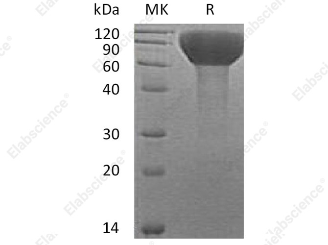 Recombinant Human FLRT3 Protein (His Tag) - 1