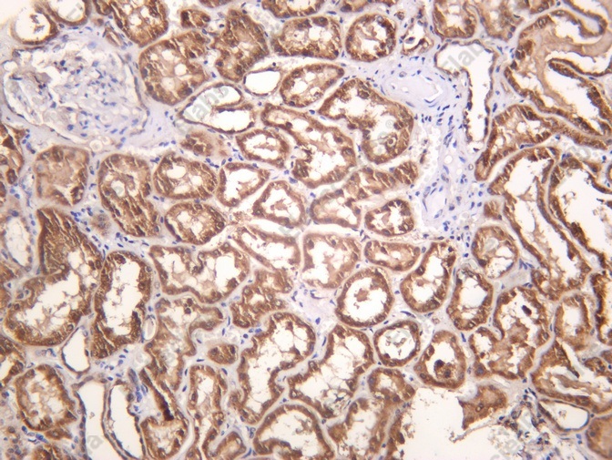 Recombinant PEPCK Monoclonal Antibody - 1
