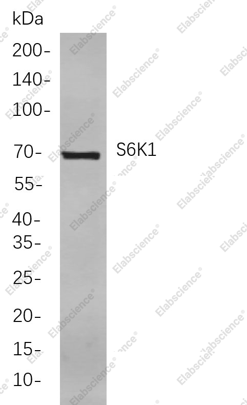 Recombinant S6K1 Monoclonal Antibody - 1