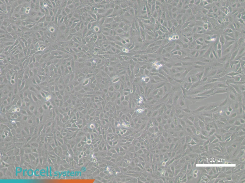 U-2 OS-GFPU-2 OS-GFP - 2