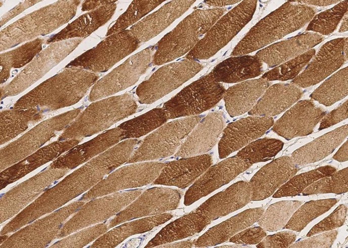CKM Monoclonal Antibody-searchlist-1