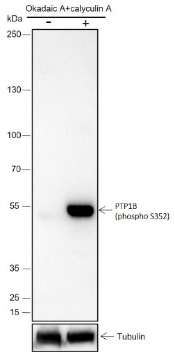 Recombinant Phospho-PTP1B (Ser352) Monoclonal Antibody-searchlist-1