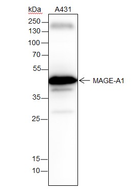 Recombinant MAGEA1 Monoclonal Antibody-searchlist-1