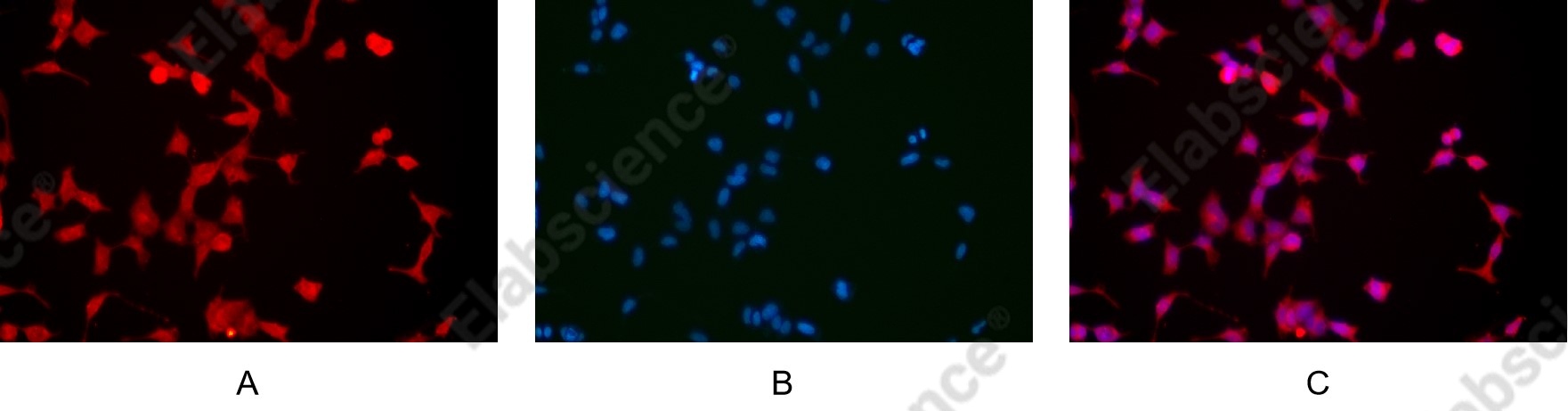 Recombinant SQSTM1/p62 Monoclonal Antibody - 8