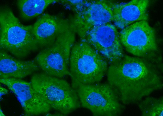 DARS Monoclonal Antibody - small - 2