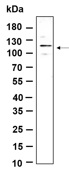 Recombinant Phospho-FAK (Tyr397) Monoclonal Antibody-searchlist-1