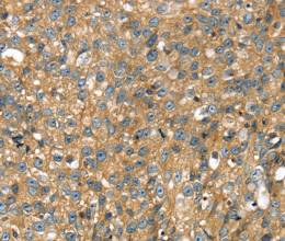 STX11 Polyclonal Antibody - 2