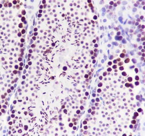 Recombinant SP1 Monoclonal Antibody - small - 5