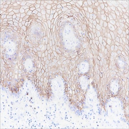 Recombinant CD138/Syndecan-1 Monoclonal Antibody-searchlist-1