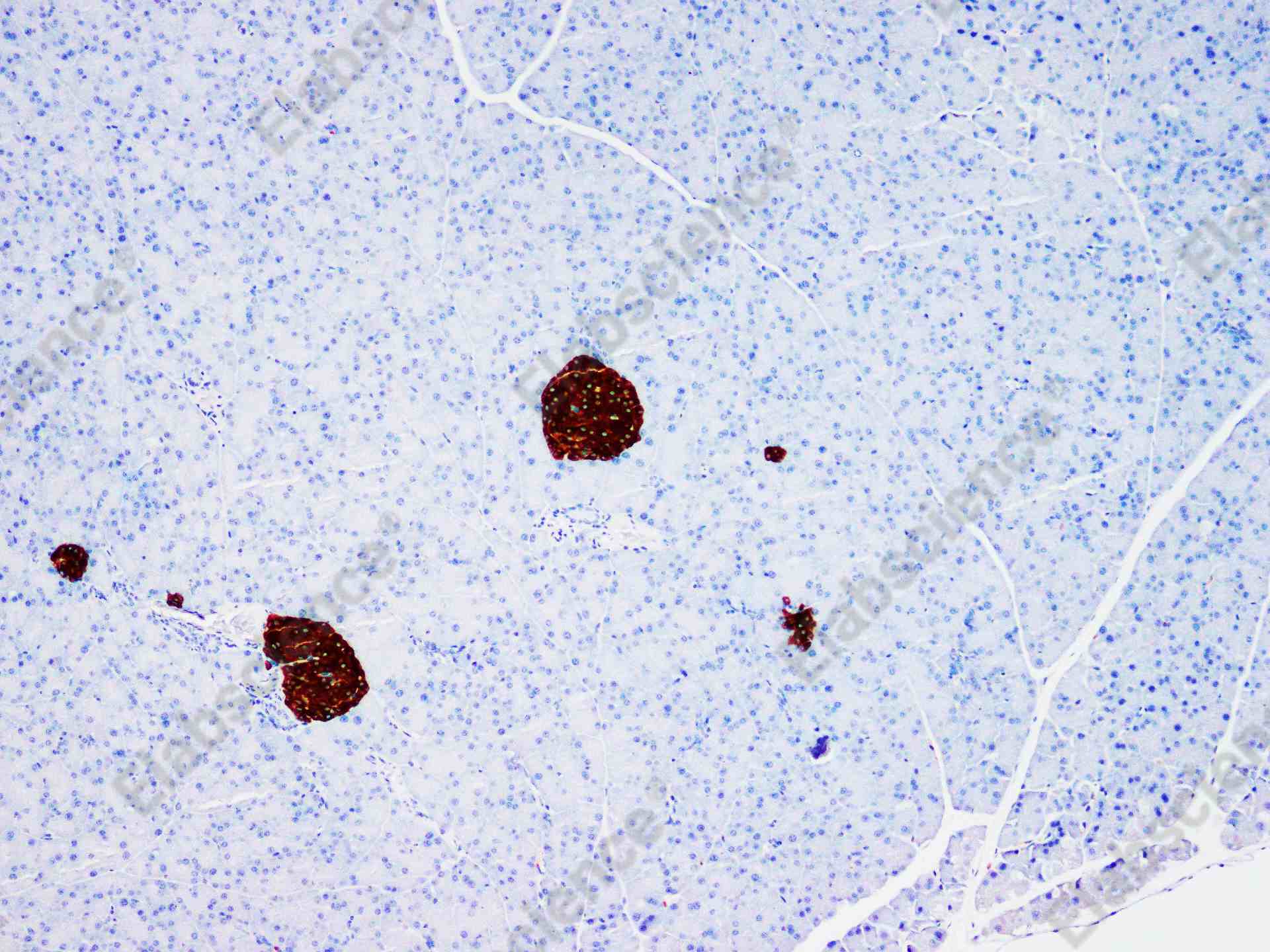Recombinant Chromogranin A/CHGA/CGA Monoclonal Antibody - 2