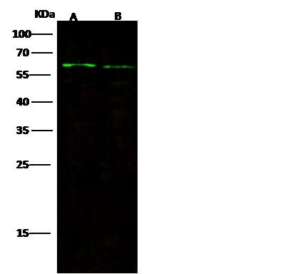 Recombinant FGFRL1/FGFR5 Monoclonal Antibody-searchlist-1