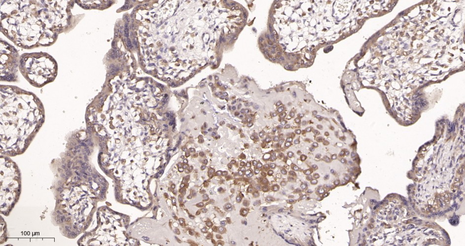 Recombinant PI3-Kinase p85 α Monoclonal Antibody - small - 2