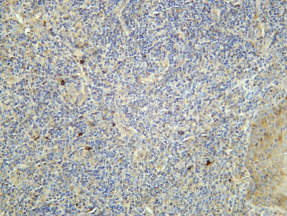 Recombinant NKp46 Monoclonal Antibody - 1