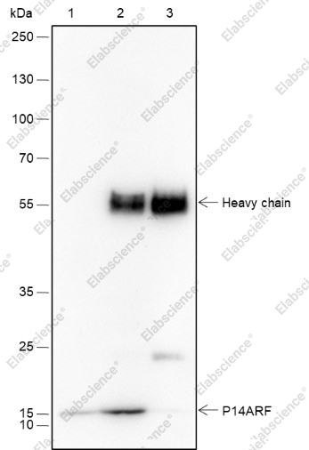 Recombinant CDKN2A/p14ARF Monoclonal Antibody - 4